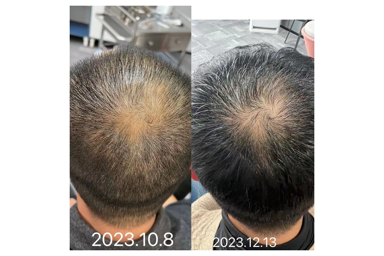 Case 01 comparison, anonymized