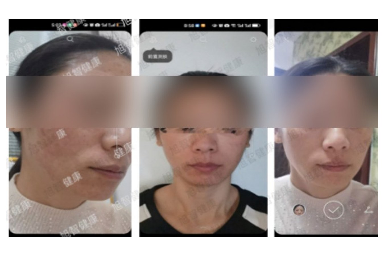 Case 06 comparison, anonymized