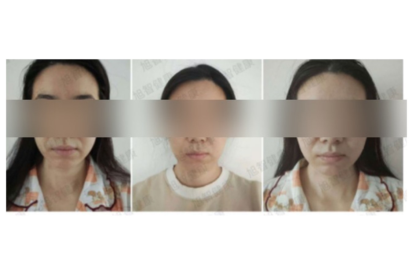 Case 07 comparison, anonymized