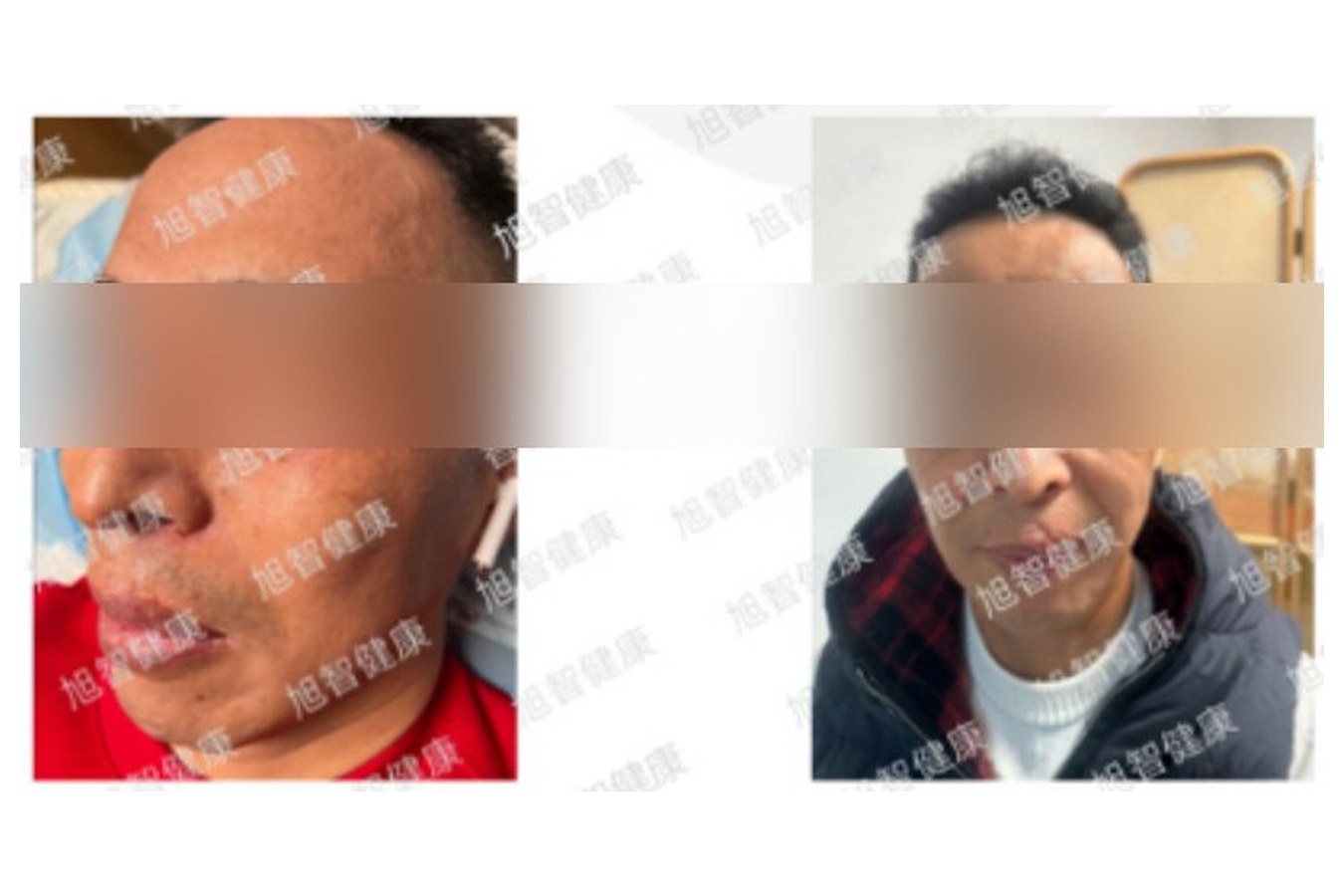Case 08 comparison, anonymized
