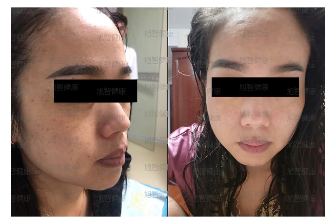 Case 09 comparison, anonymized