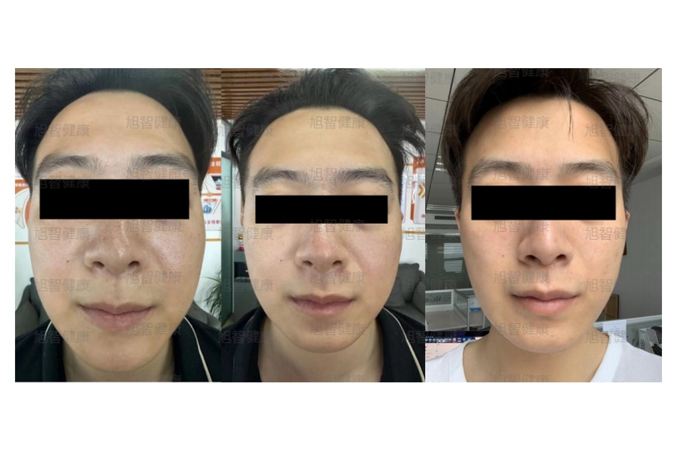 Case 10 comparison, anonymized