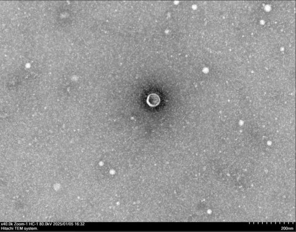 TEM micrograph of a single vesicle, Hitachi TEM system, 200 nm scale bar